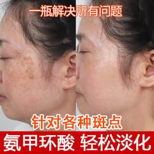 5% Tranexamic Acid Essence, Niacinamide Original Solution, High Concentration Melanin Inhibitor, Fades Dark Spots, Tranexamic Acid Original Solution